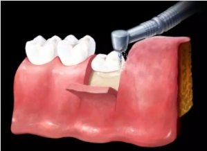 Tonia Dental Clinic - Clinica Stomatologica